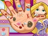 Play Rapunzel Hand Doctor